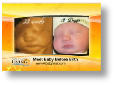 4d ultrasound 3d ultrasound